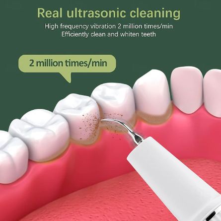 Dentora | Professioneller Ultraschall-Zahnsteinentferner für effektive Zahnpflege zu Hause
