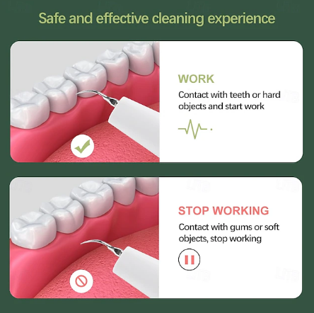 Dentora | Professioneller Ultraschall-Zahnsteinentferner für effektive Zahnpflege zu Hause